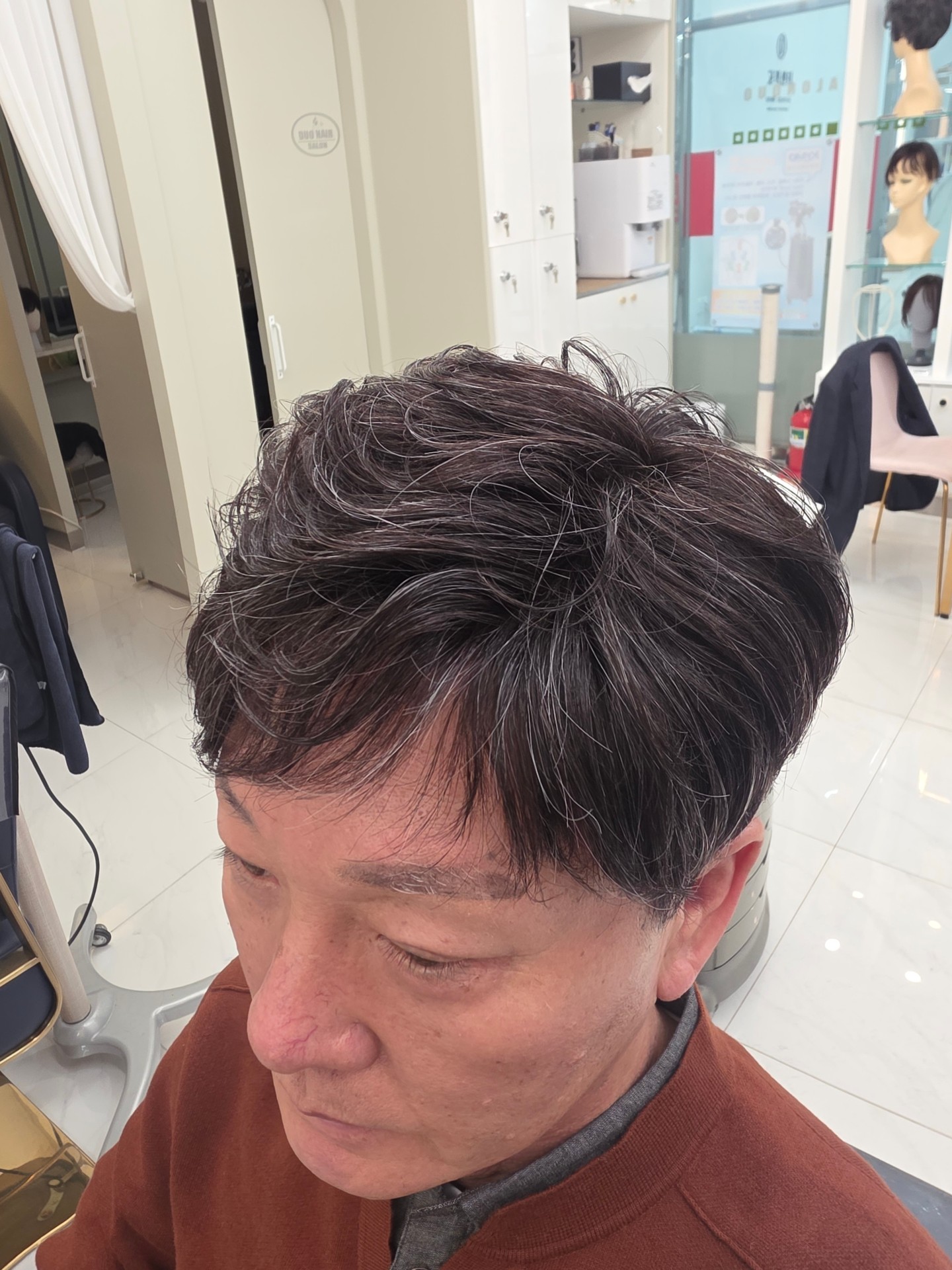 시술사진