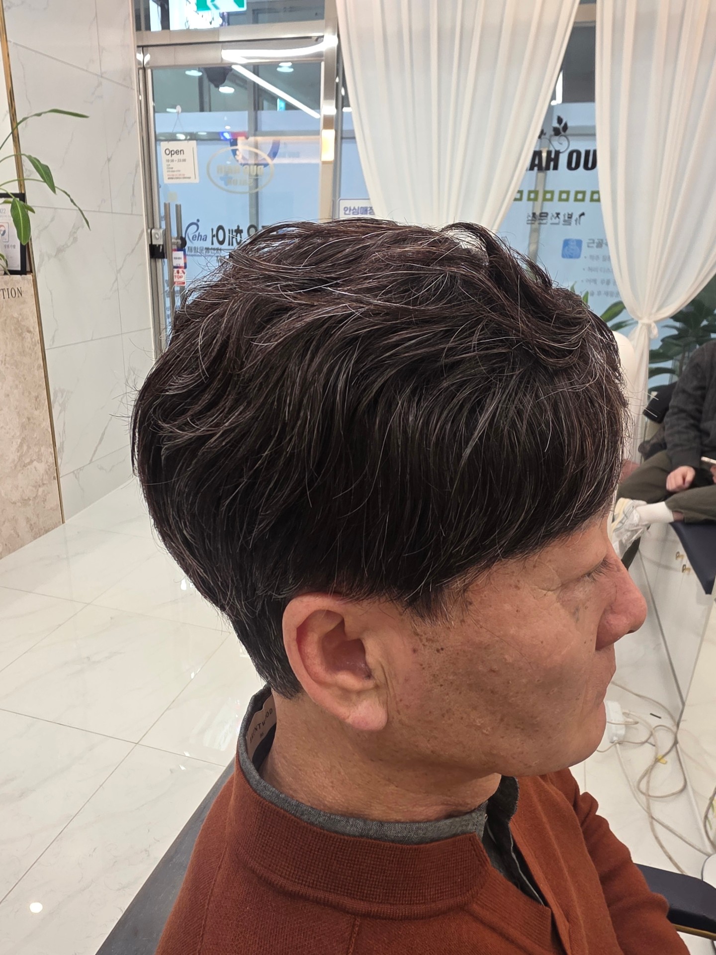 시술사진